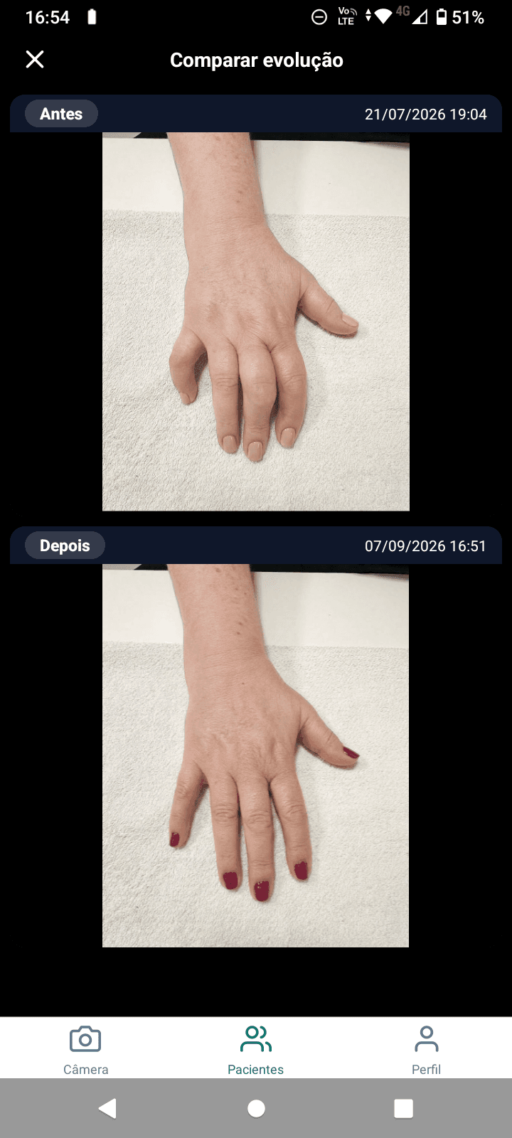 Antes e depois